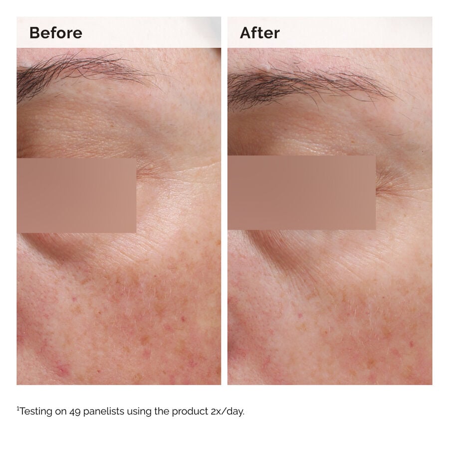 niacinamide-5-face-and-body-emulsion-w6 2024-08-23-ORD-Nia-5pct-Face-Body-B-A-Elasticity-Global-02-1x1.jpg