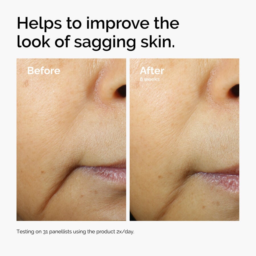 caffeine-3-escin-1-face-serum-m4 ord-caffeine-3pct-escin-1pct-face-serum-before-after-sagging.jpg