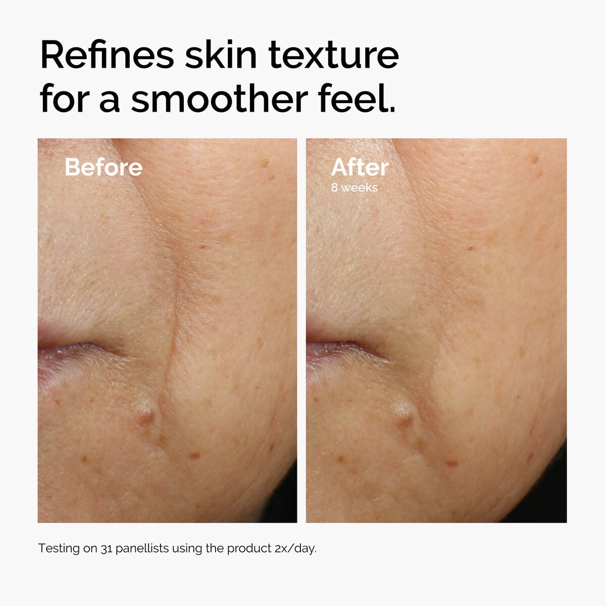 caffeine-3-escin-1-face-serum-m4 ord-caffeine-3pct-escin-1pct-face-serum-before-after-texture.jpg