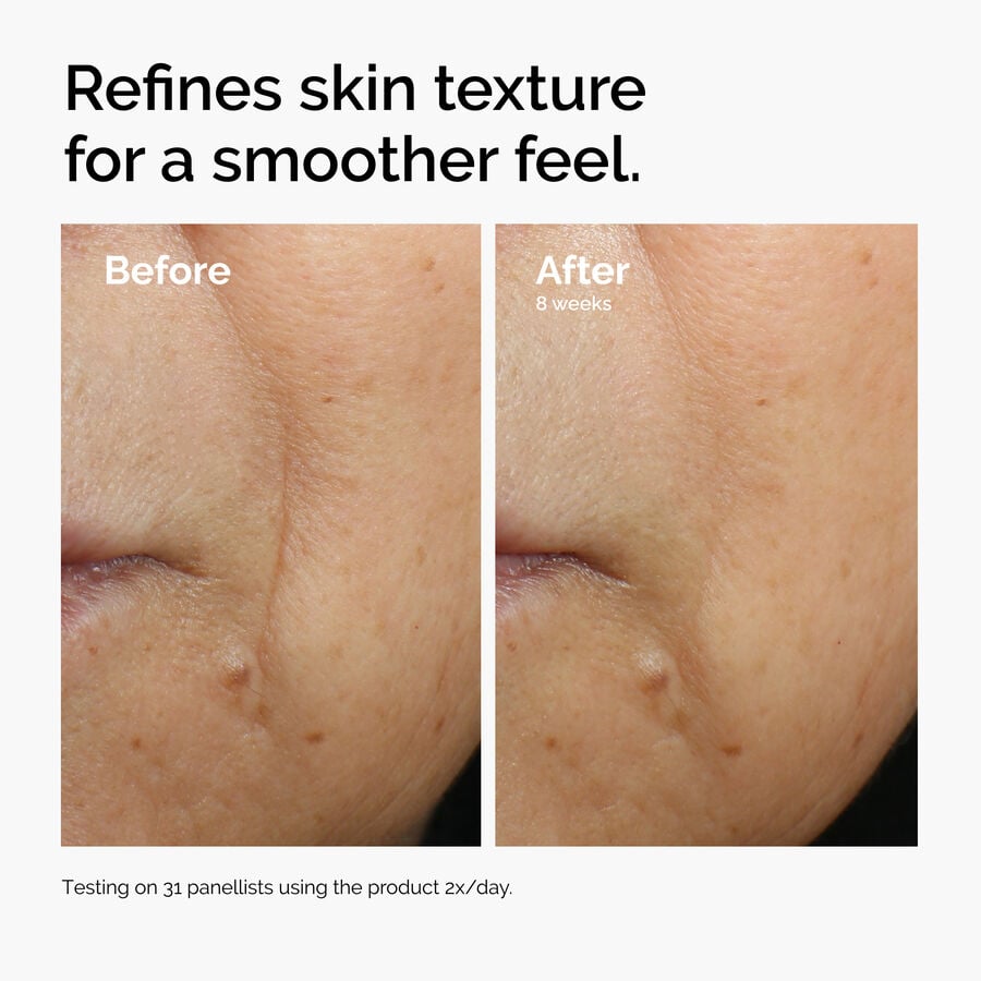 caffeine-3-escin-1-face-serum-m4 ord-caffeine-3pct-escin-1pct-face-serum-before-after-texture.jpg