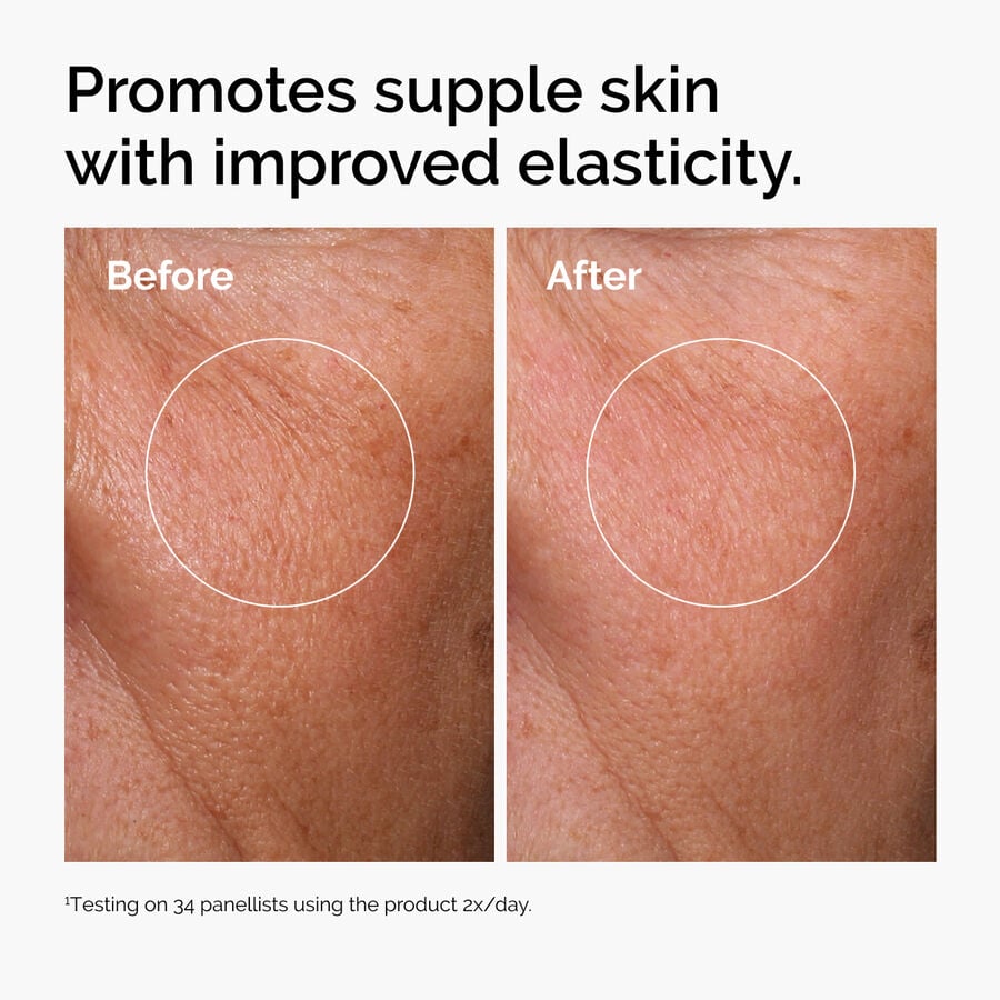 hyaluronic-acid-2-b5-with-ceramides-z7 ord-hyaluronic-acid-2pct-b5-hydrating-serum-before-after-elasticity.jpg
