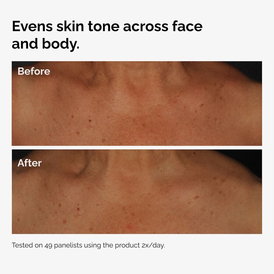 the-body-care-collection-v5 ord-niacinamide-face-body-serum-before-after-even-tone-graphic.jpg