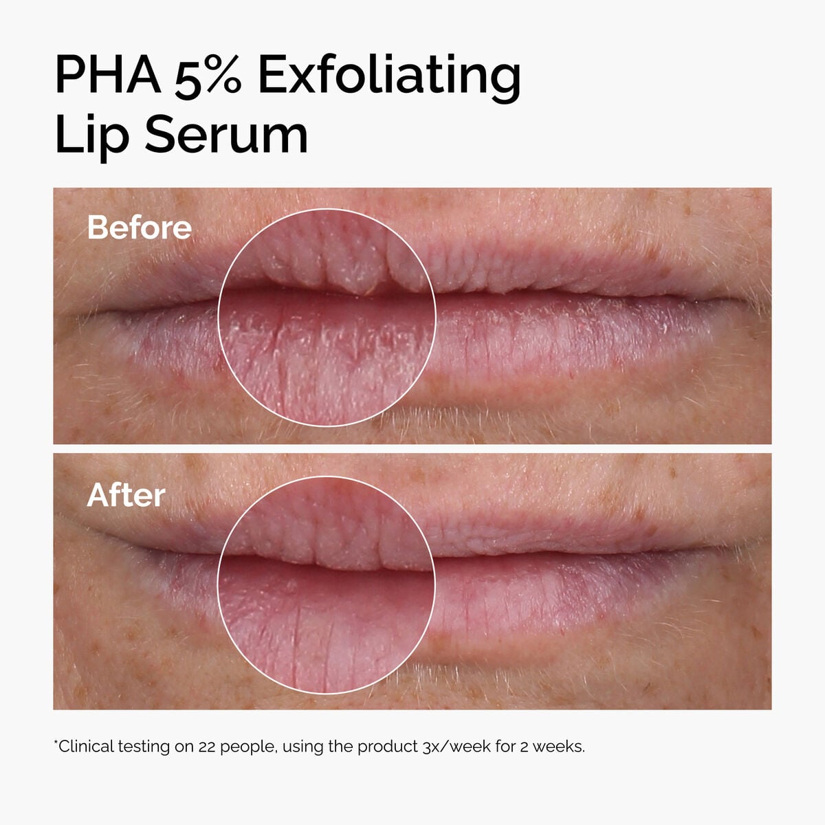 pha-5-exfoliating-lip-serum-h5 ord-pha-5pct-lip-exfoliating-serum-before-after.jpg