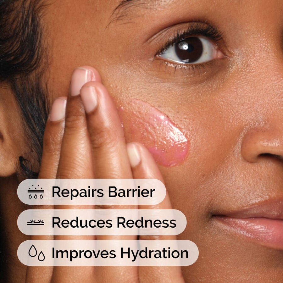 soothing-and-barrier-support-serum-set-x4 ord-soothing-barrier-support-serum-model-application-with-benefits.jpg
